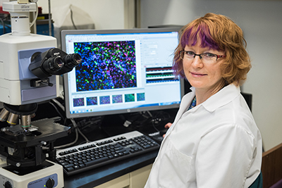 brain tumor researcher with microscope and computer