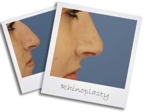 rhino8small